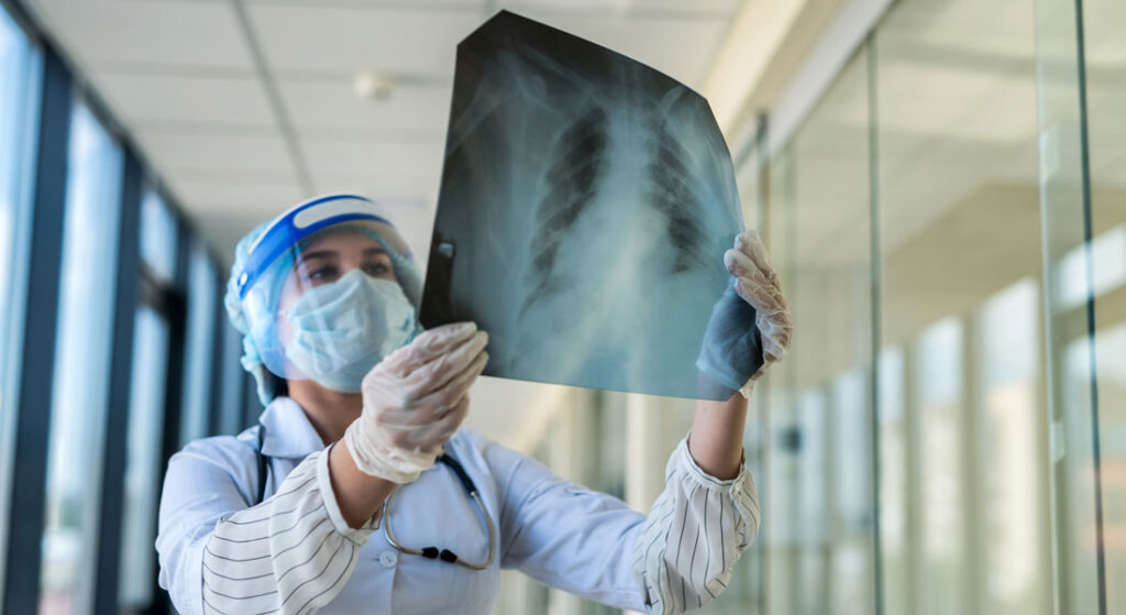 Foto Como evitar que a gripe vire pneumonia; especialista recomenda vacina