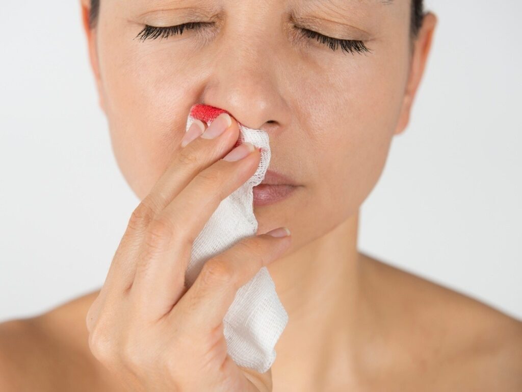 Foto 60% das pessoas vão ter sangramento nasal durante a vida